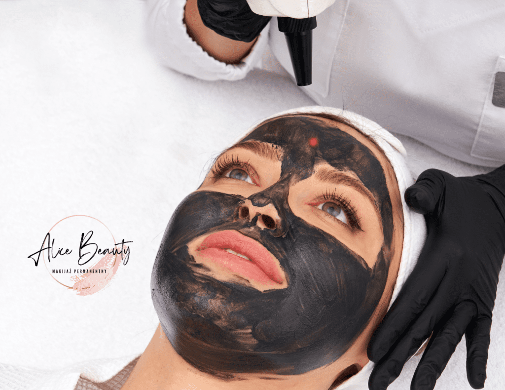 peeling węglowy świdnica