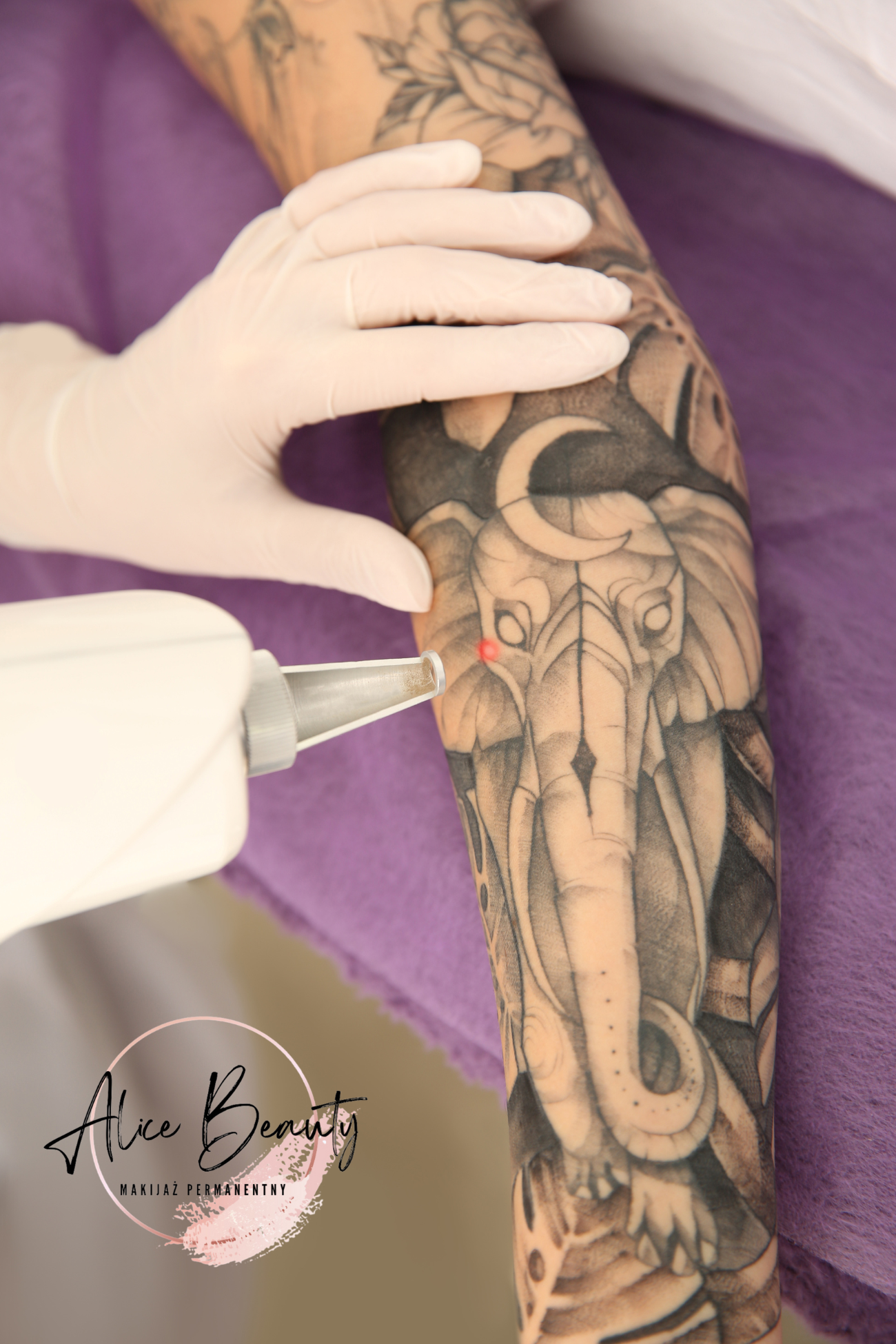 usuwanie tatuażu świdnica