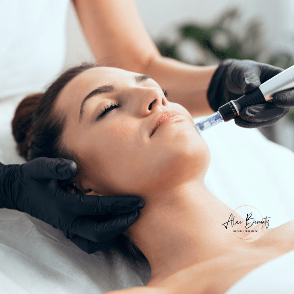 mezoterapia mikroigłowa Świdnica